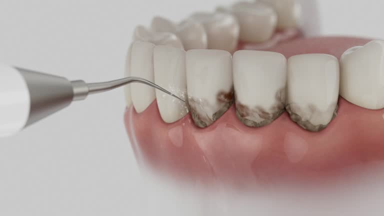 Reliable Dental Implants contractor in Wamac, IL by Smile Center Dentistry
